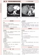 澳门永利赌场_澳门永利网址_澳门永利网站_科学网腹盆部影像诊断陷阱与典型征